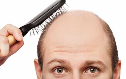 выпадение волос на нервной почве: вам помогут натуральные масла
